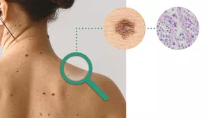 Ilustrační obrázek