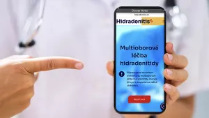 Ilustrační obrázek