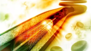 Ilustrační obrázek