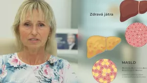 Ilustrační obrázek