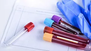 Ilustrační obrázek