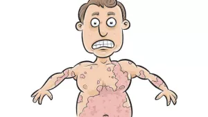 Ilustrační obrázek