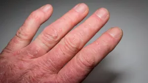 Ilustrační obrázek