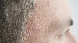 Ilustrační obrázek