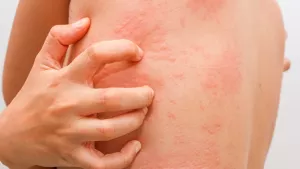 Ilustrační obrázek