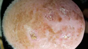 Ilustrační obrázek