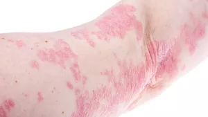 Ilustrační obrázek