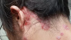 Ilustrační obrázek