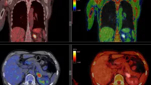 Ilustrační obrázek