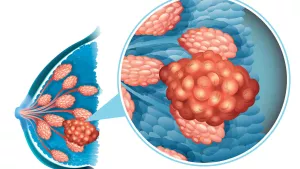 Ilustrační obrázek