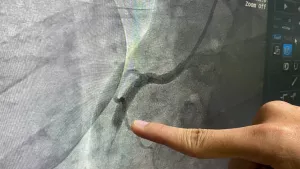 Ilustrační obrázek