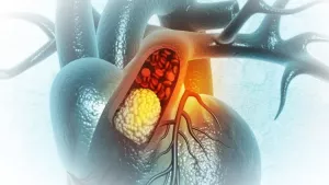 Ilustrační obrázek