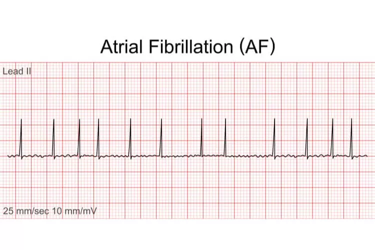 Ilustrační obrázek