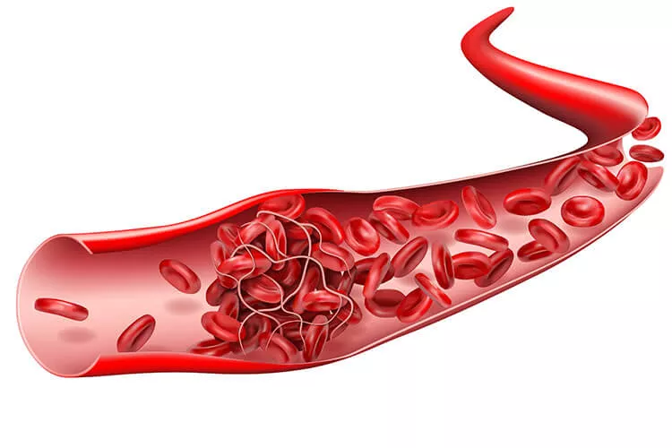 Ilustrační obrázek