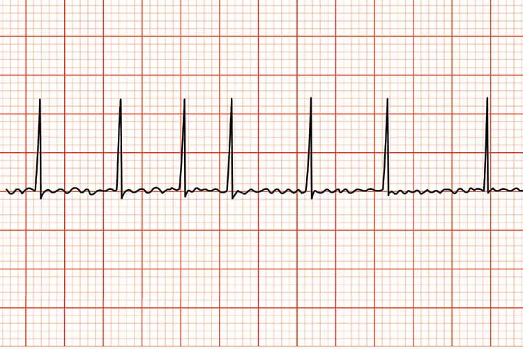 Ilustrační obrázek