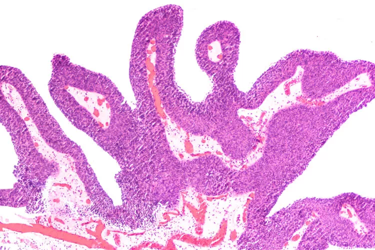 Ilustrační obrázek