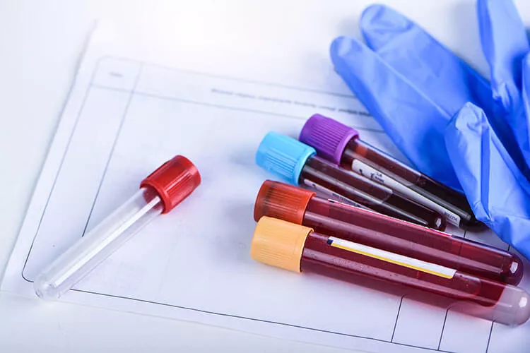 Ilustrační obrázek