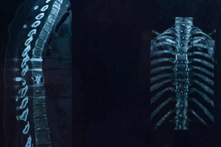 Ilustrační obrázek