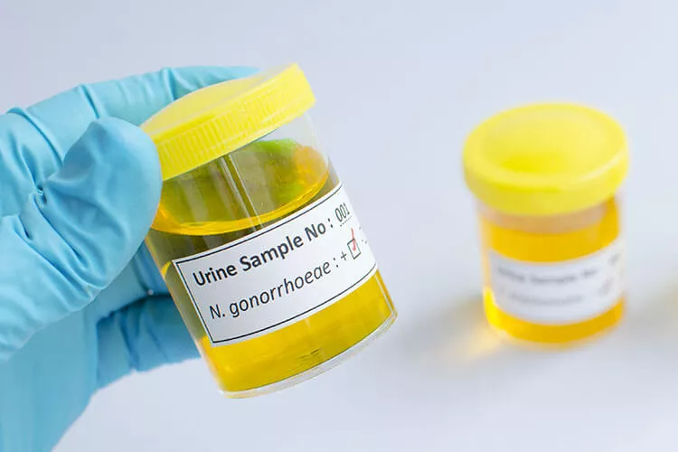 Ilustrační obrázek