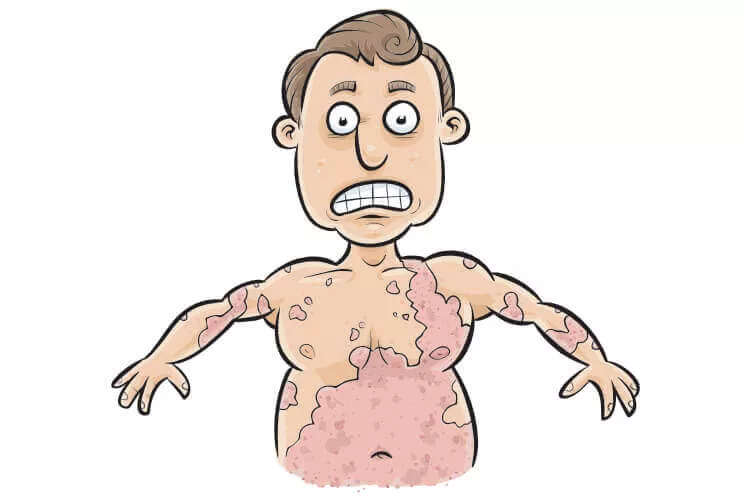 Ilustrační obrázek