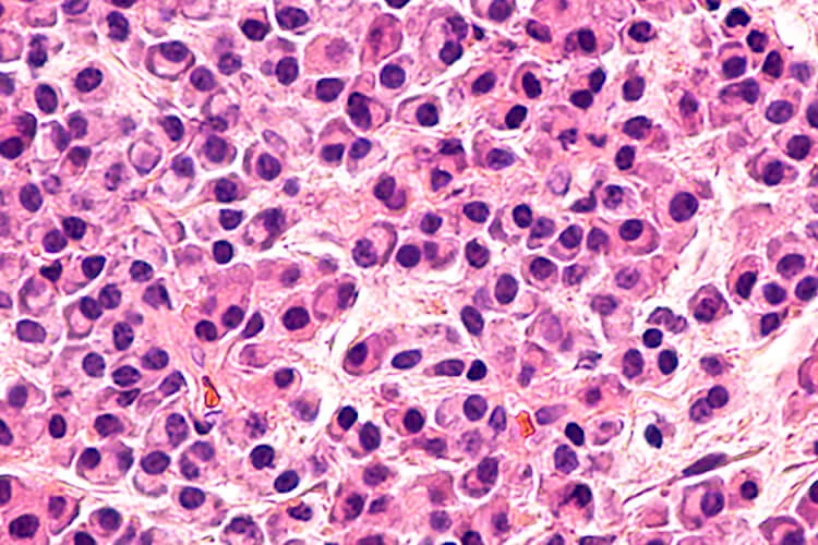 Ilustrační obrázek