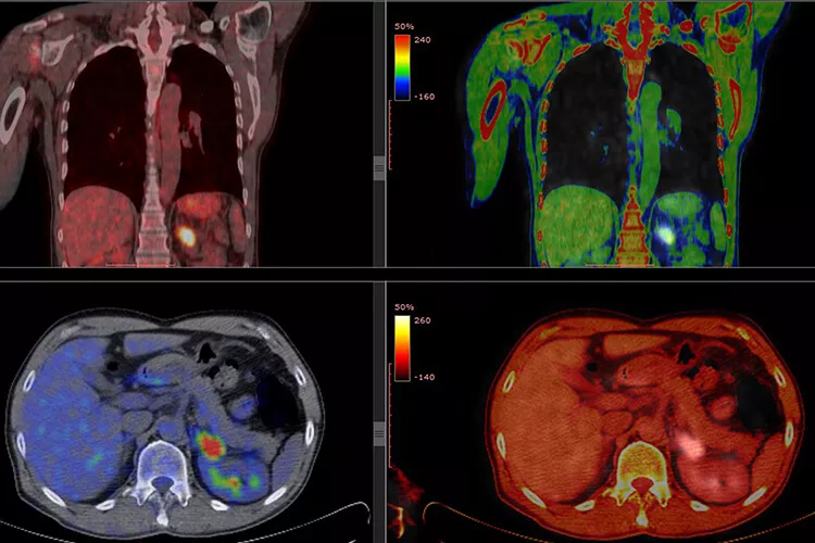 Ilustrační obrázek