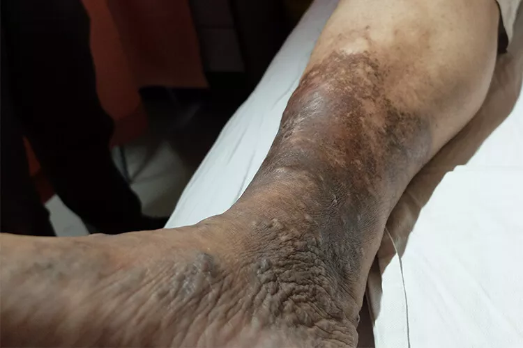 Ilustrační obrázek